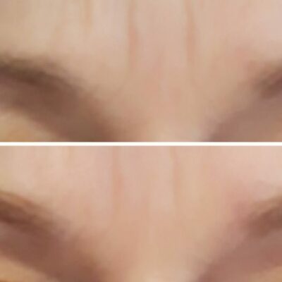 Brow Lift (rehaussement de sourcils)  naturel sans teinture