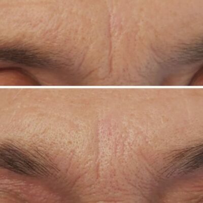 Brow Lift (rehaussement de sourcils)  naturel sans teinture